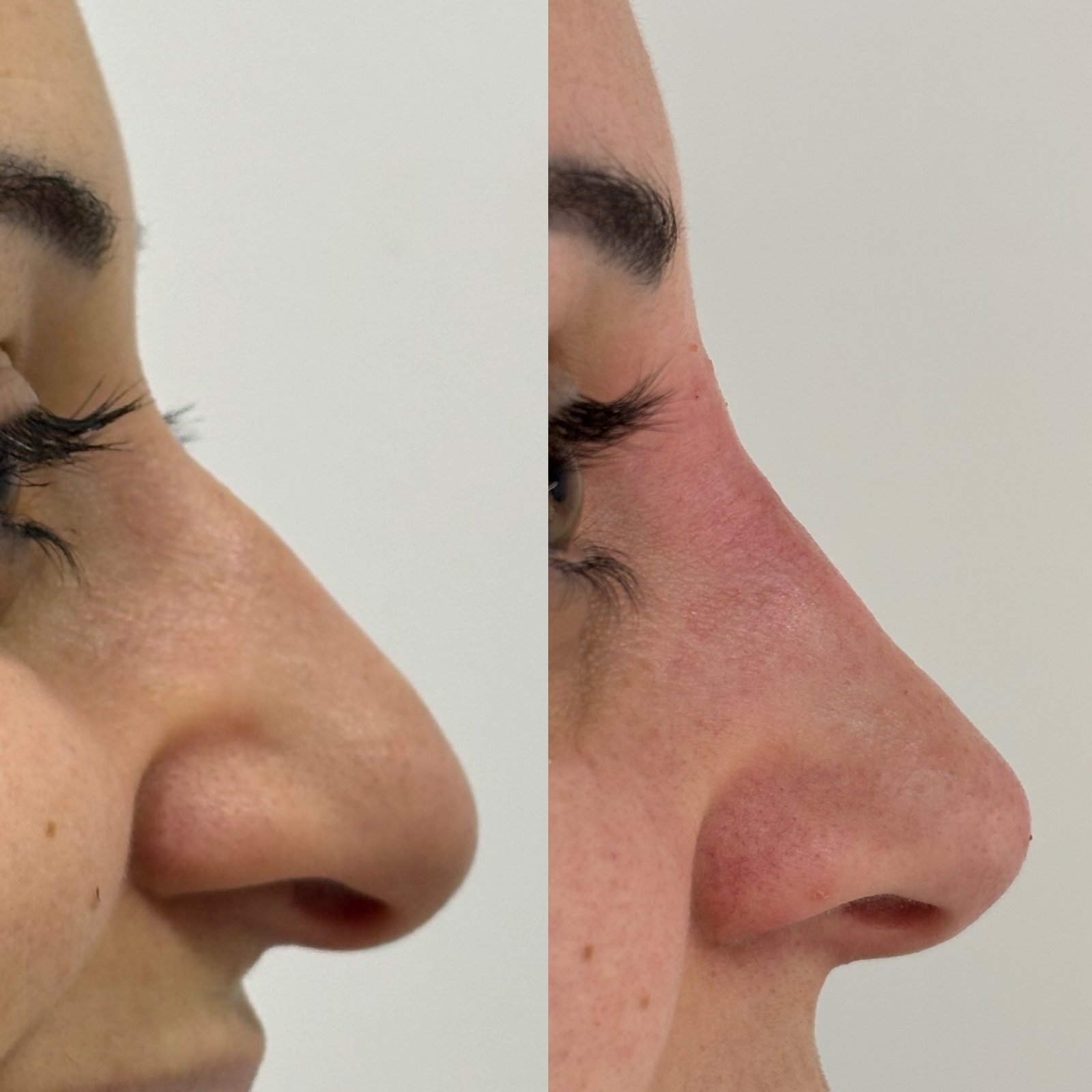 17790628-A77A-4CE7-92B4-768DBF9162AB