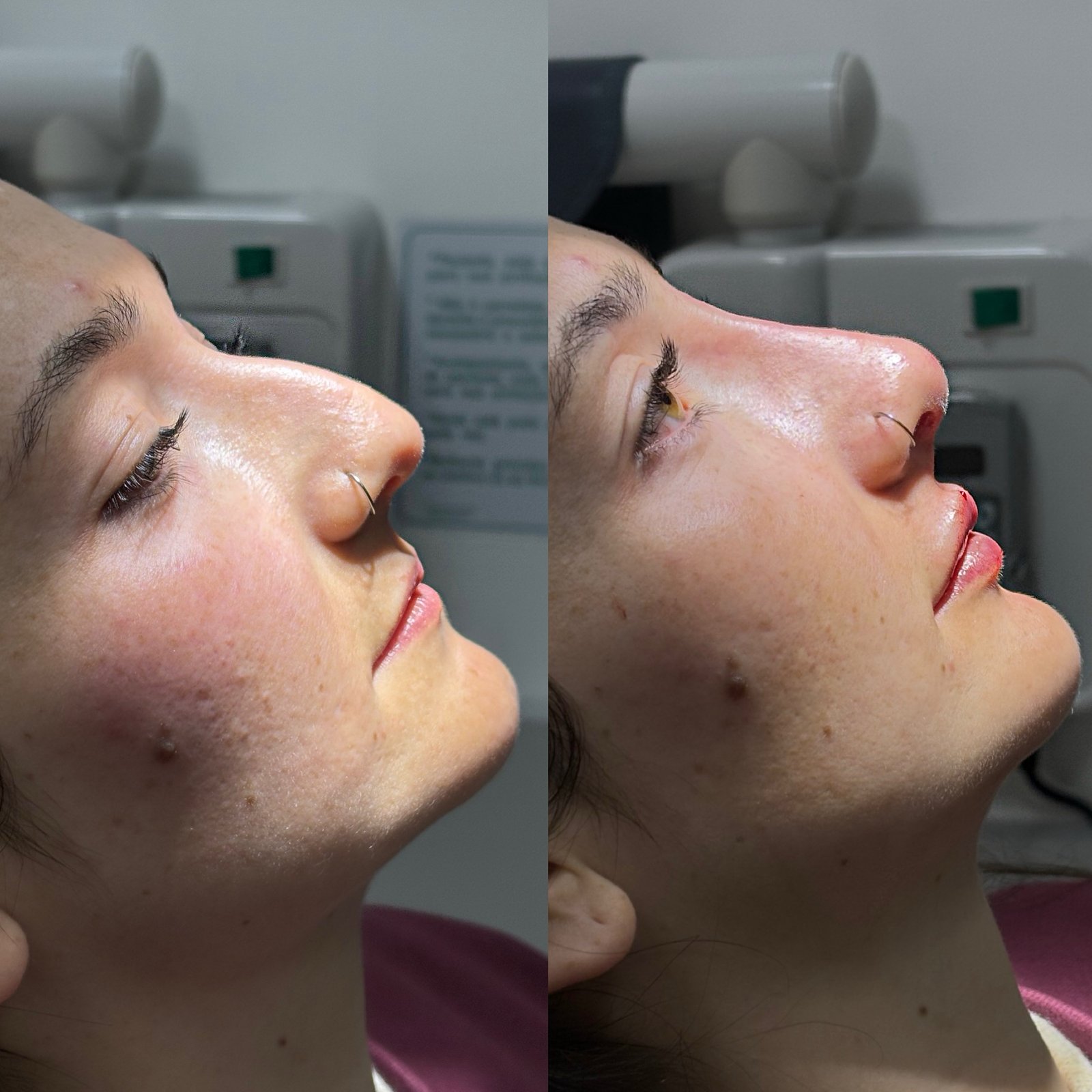 F22950E2-D722-4A48-BF3C-AFA37EF6B728