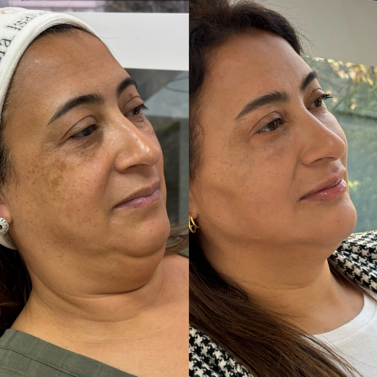 F669EE36-29D6-4317-A15C-01272426B044