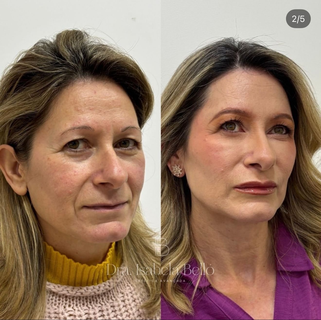 WhatsApp Image 2025-06-08 at 22.09.27